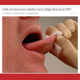 4.0% of American Adults Carry High-Risk Oral HPV